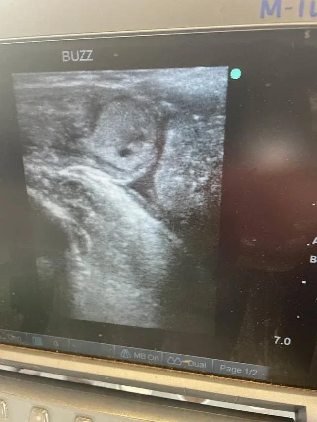 An ultrasound of one of our cows following artificial insemination!